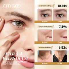 CITYGOO calendula y aceite de aguacate brindan nutrición suave para el contorno de ojos.