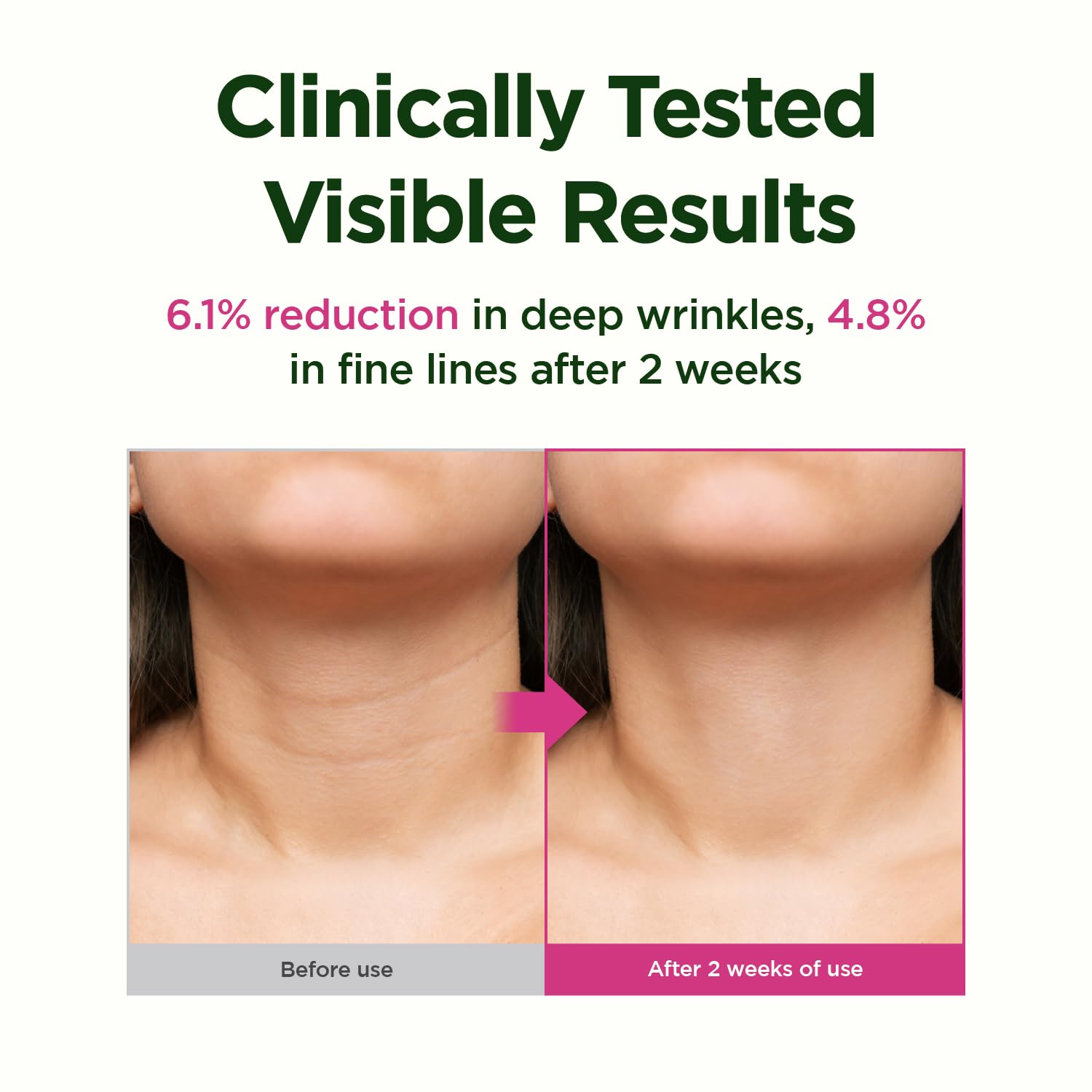 Tube of CKD neck cream emphasizing easy application and daily routine