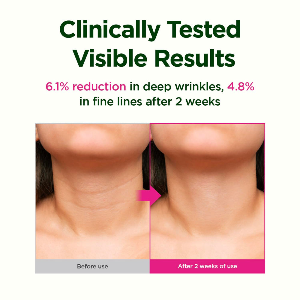 Tube of CKD neck cream emphasizing easy application and daily routine