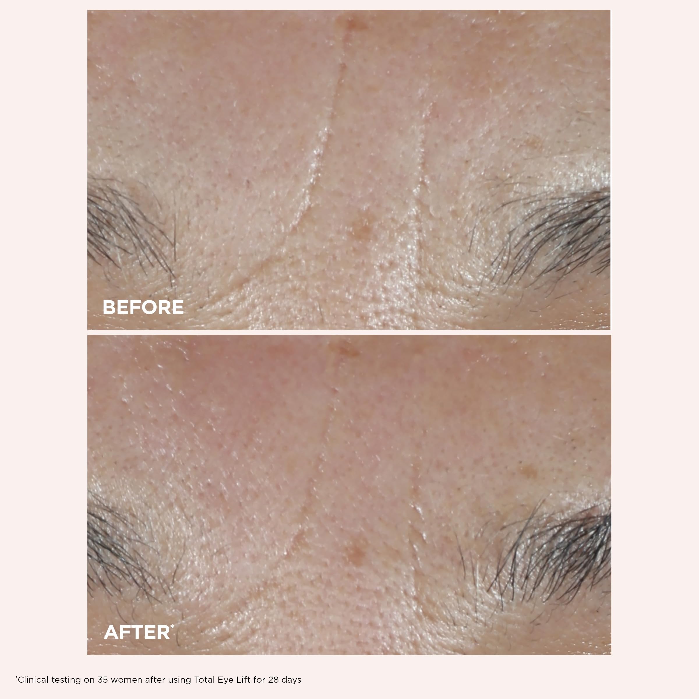 Clarins Total Eye Lift under-eye application shot, gentle tapping technique into skin