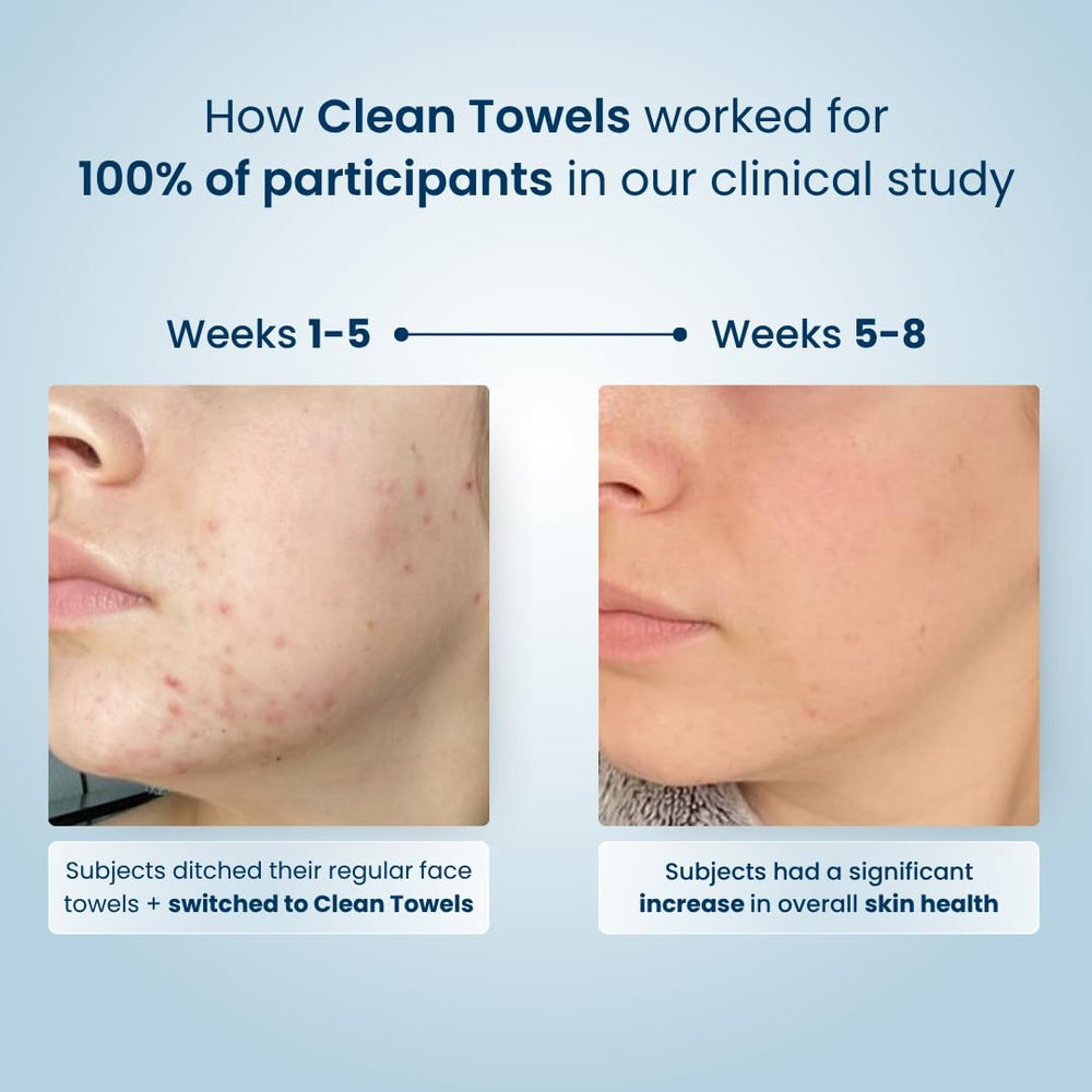 Apoya la barrera cutánea para piel equilibrada con Clean Skin Club.