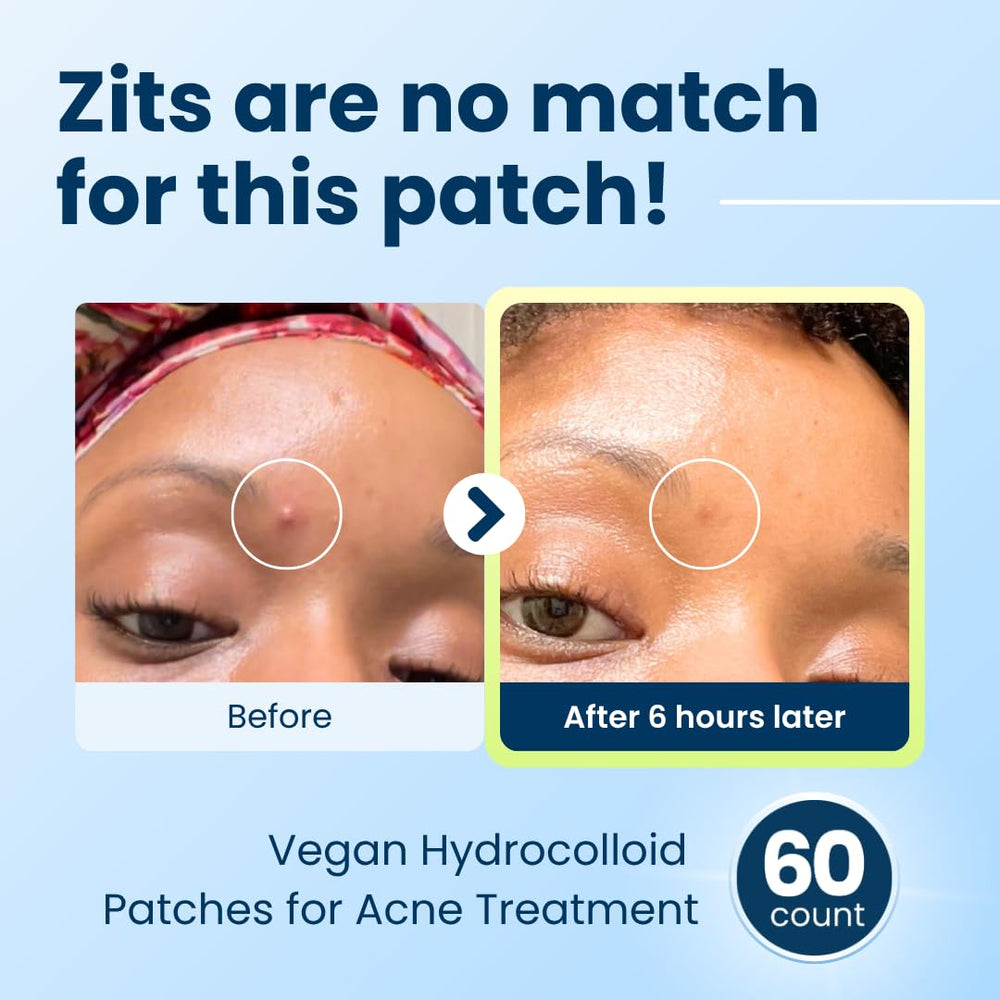 Parche hidrocoloide vegano DermaDot, suave para piel sensible.