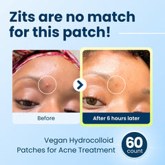 Parche hidrocoloide vegano DermaDot, suave para piel sensible.