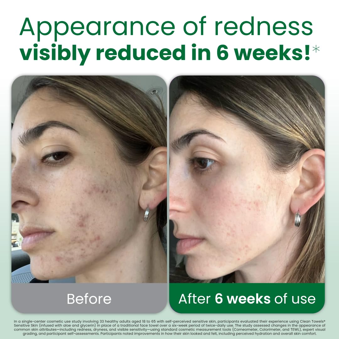 CLEAN SKIN CLUB Toallas faciales desechables Aloe: higiene rápida para piel sensible