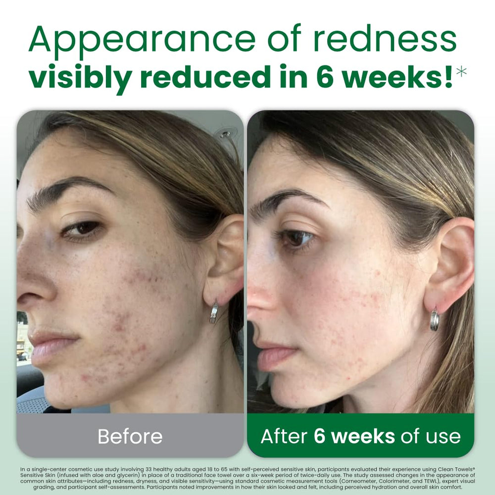 CLEAN SKIN CLUB Toallas faciales desechables Aloe: higiene rápida para piel sensible