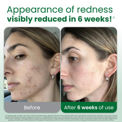 CLEAN SKIN CLUB Toallas faciales desechables Aloe: higiene rápida para piel sensible