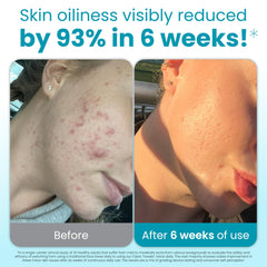 CLEAN SKIN CLUB toallas faciales desechables para eliminación de residuos de maquillaje.