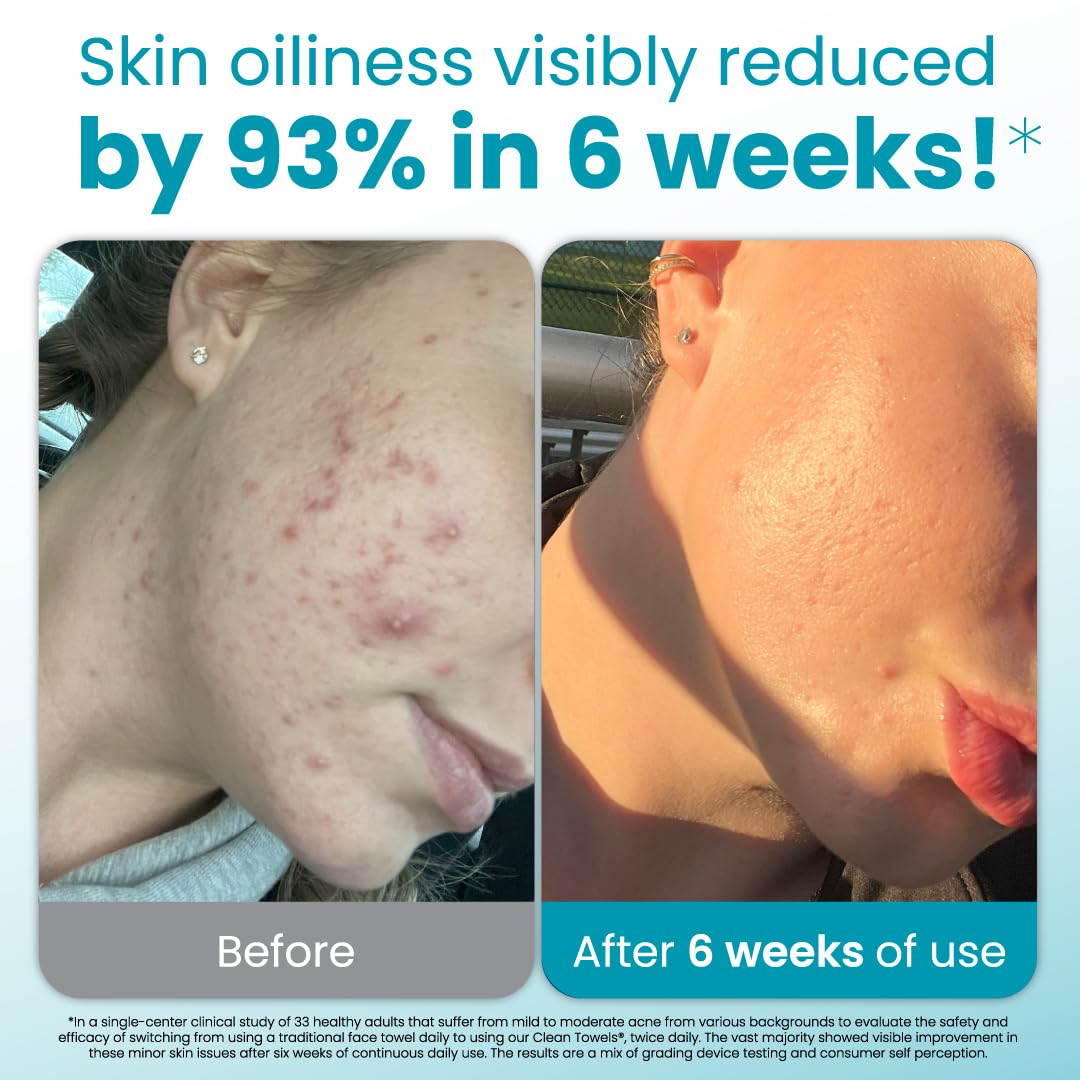 Clean Skin Club face towel with textured exfoliation dots to remove buildup for a clearer feeling