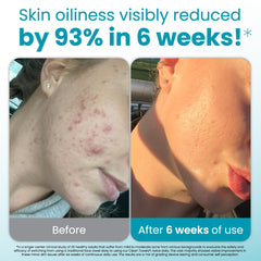 Clean Skin Club face towel with textured exfoliation dots to remove buildup for a clearer feeling