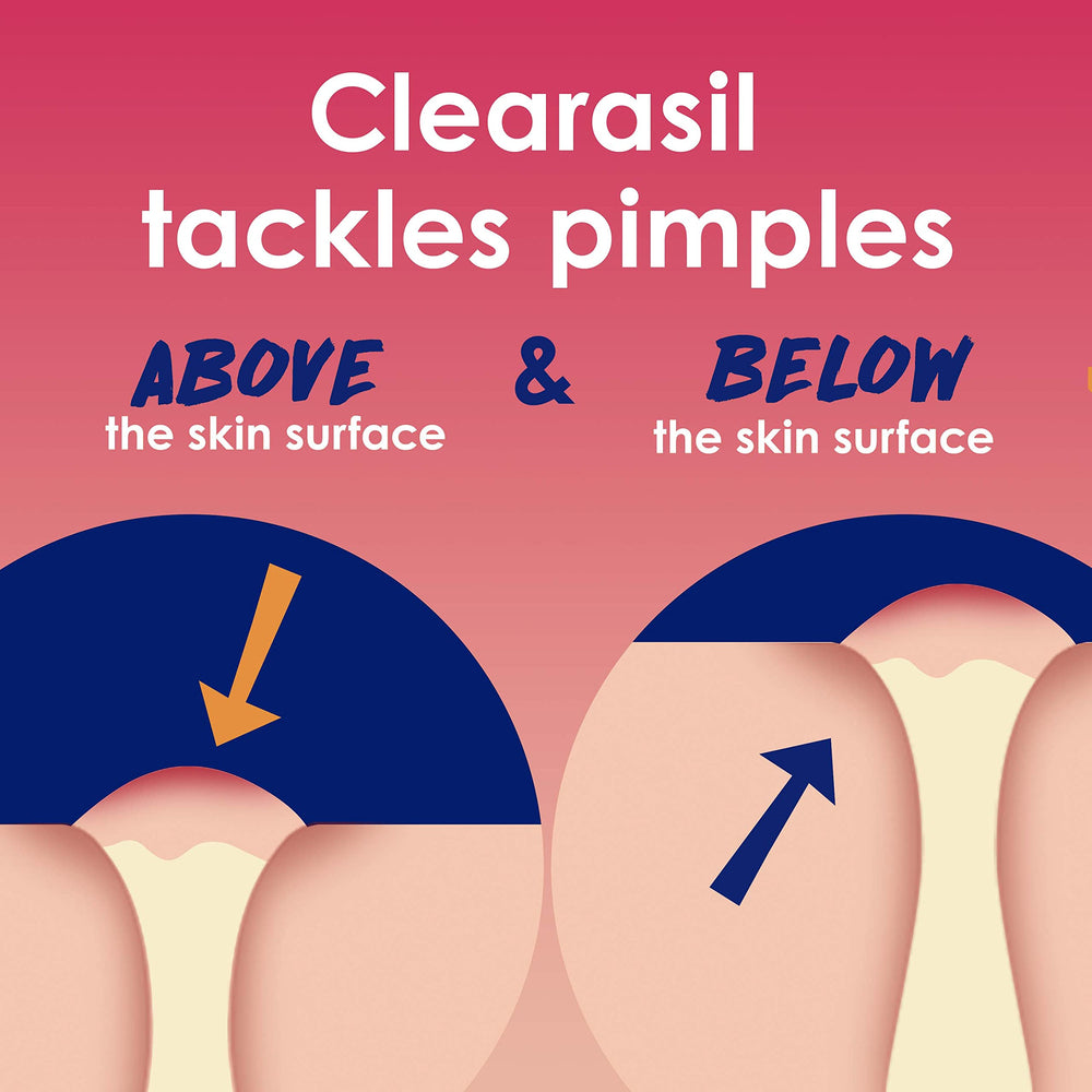 Clearasil Rapid Rescue: limpieza profunda que elimina aceite y suciedad de poros