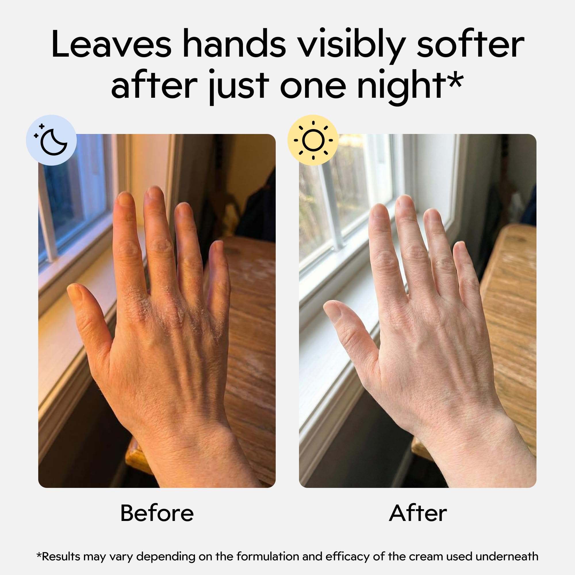 Clearbody Organics hypoallergenic gloves protect cracked hands with breathable fabric