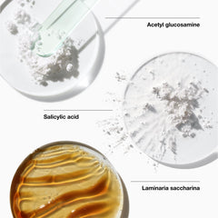 Clinique Acne Solutions Daily Foam Cleanser foamy lather close-up for gentle cleansing.