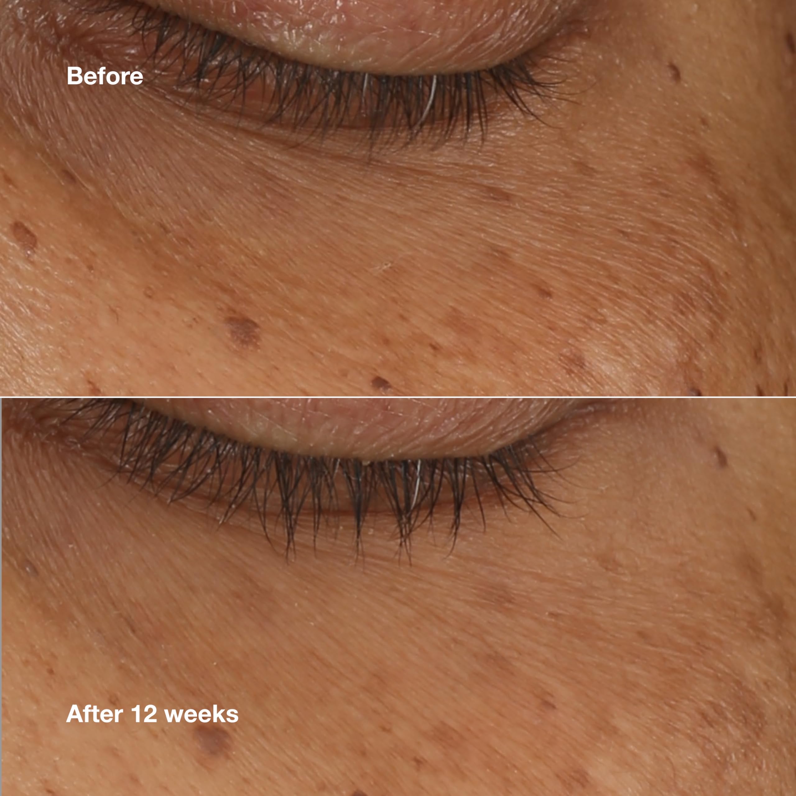 Close-up of Clinique All About Eyes Serum Swirl on skin for smoothness.