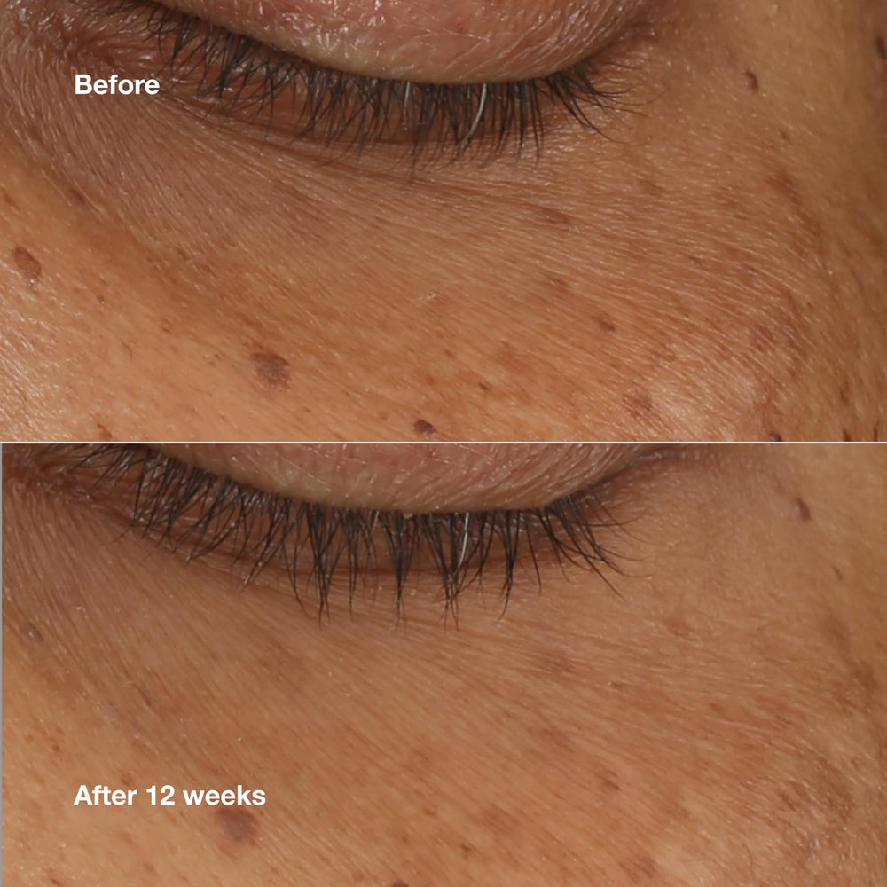 Close-up of Clinique All About Eyes Serum Swirl on skin for smoothness.