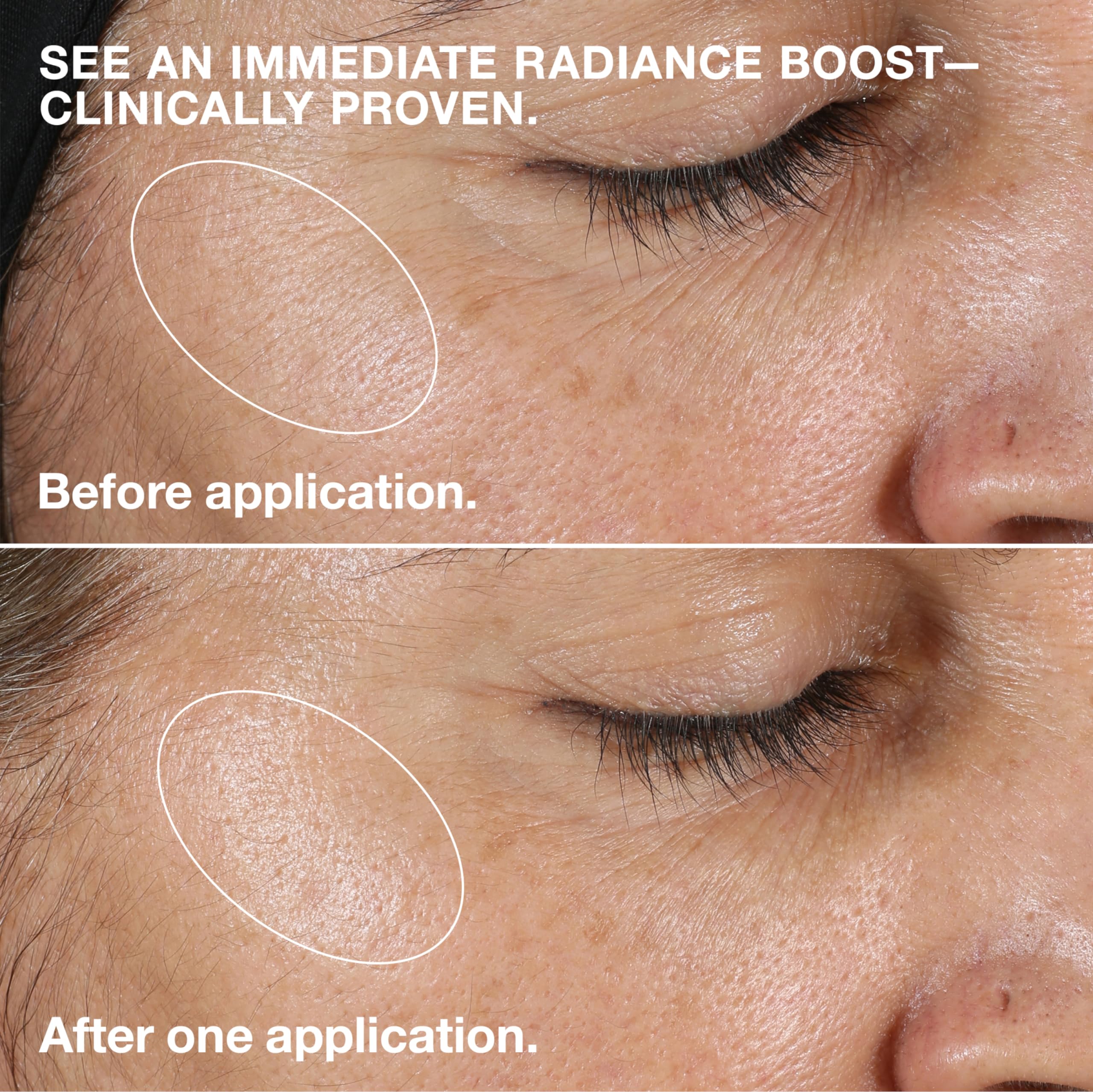 Clinique Clarifying Lotion 2 daily exfoliation as part of routine.