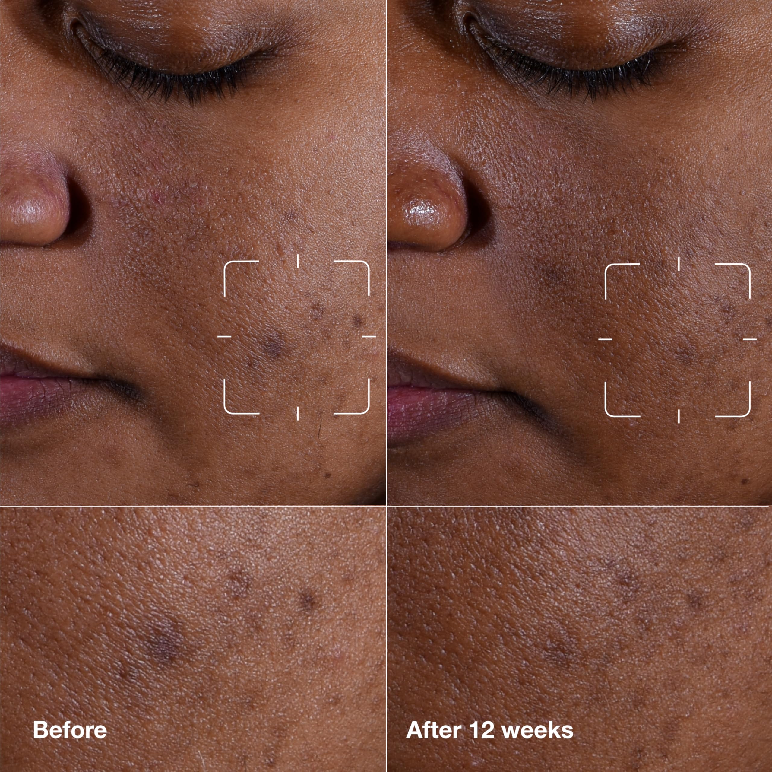 Clinique Even Better Serum pump dispensing for easy daily use
