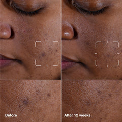 Clinique Even Better Serum pump dispensing for easy daily use