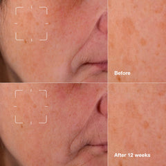 Serum on hand showing lightweight texture and quick absorption