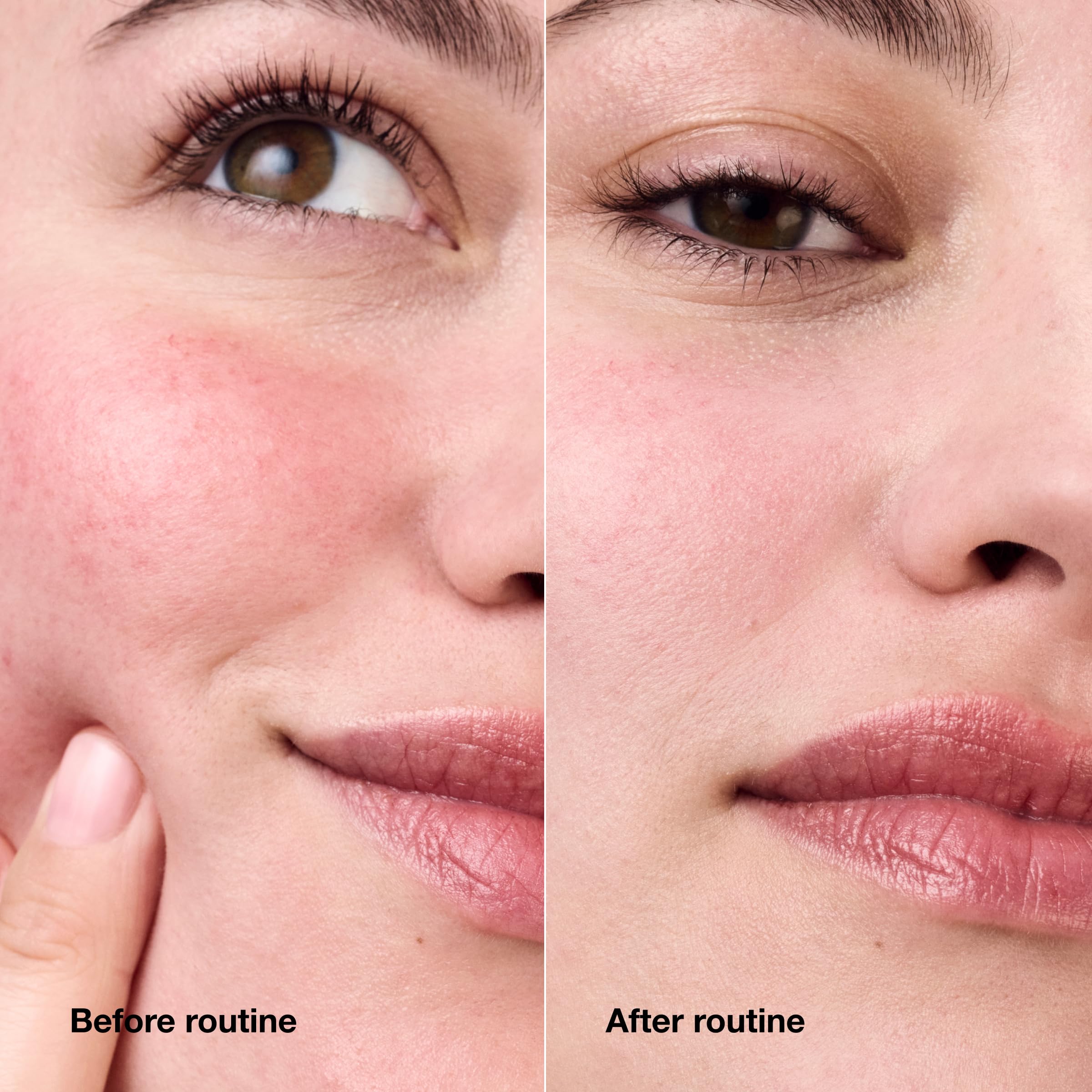 For rosacea-prone skin, Clinique Cream offers gentle hydration.