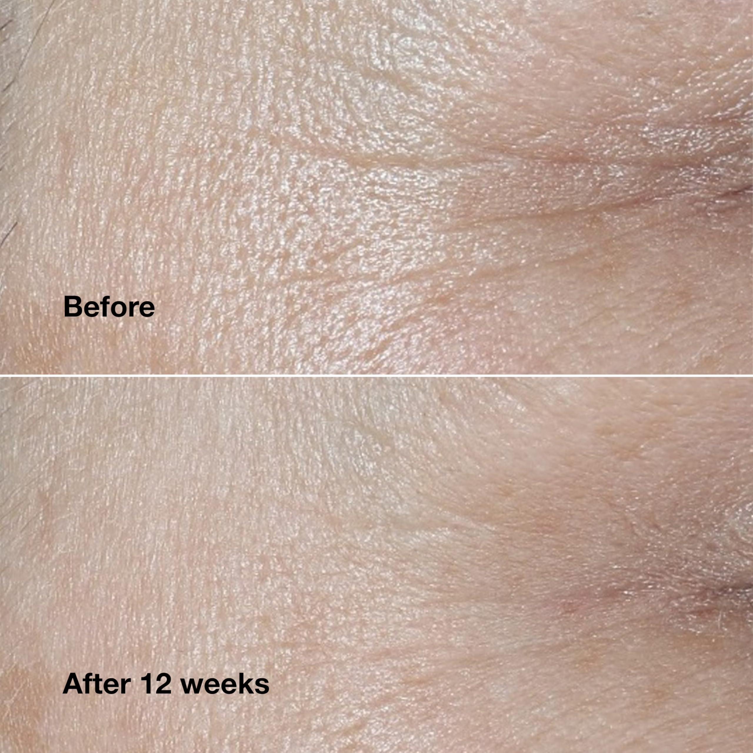 Clinique Smart Clinical Repair Cream application demonstrates instant hydrating moment.