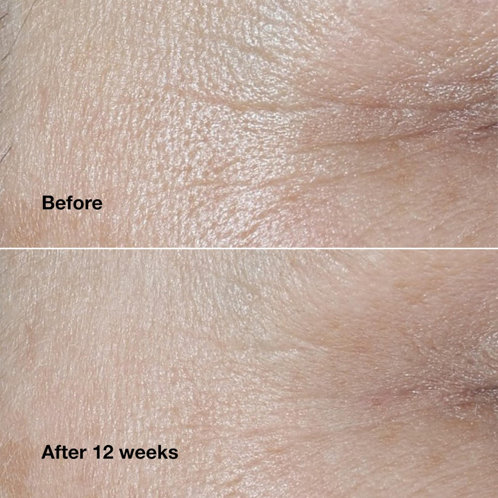Clinique Smart Clinical Repair Cream application demonstrates instant hydrating moment.