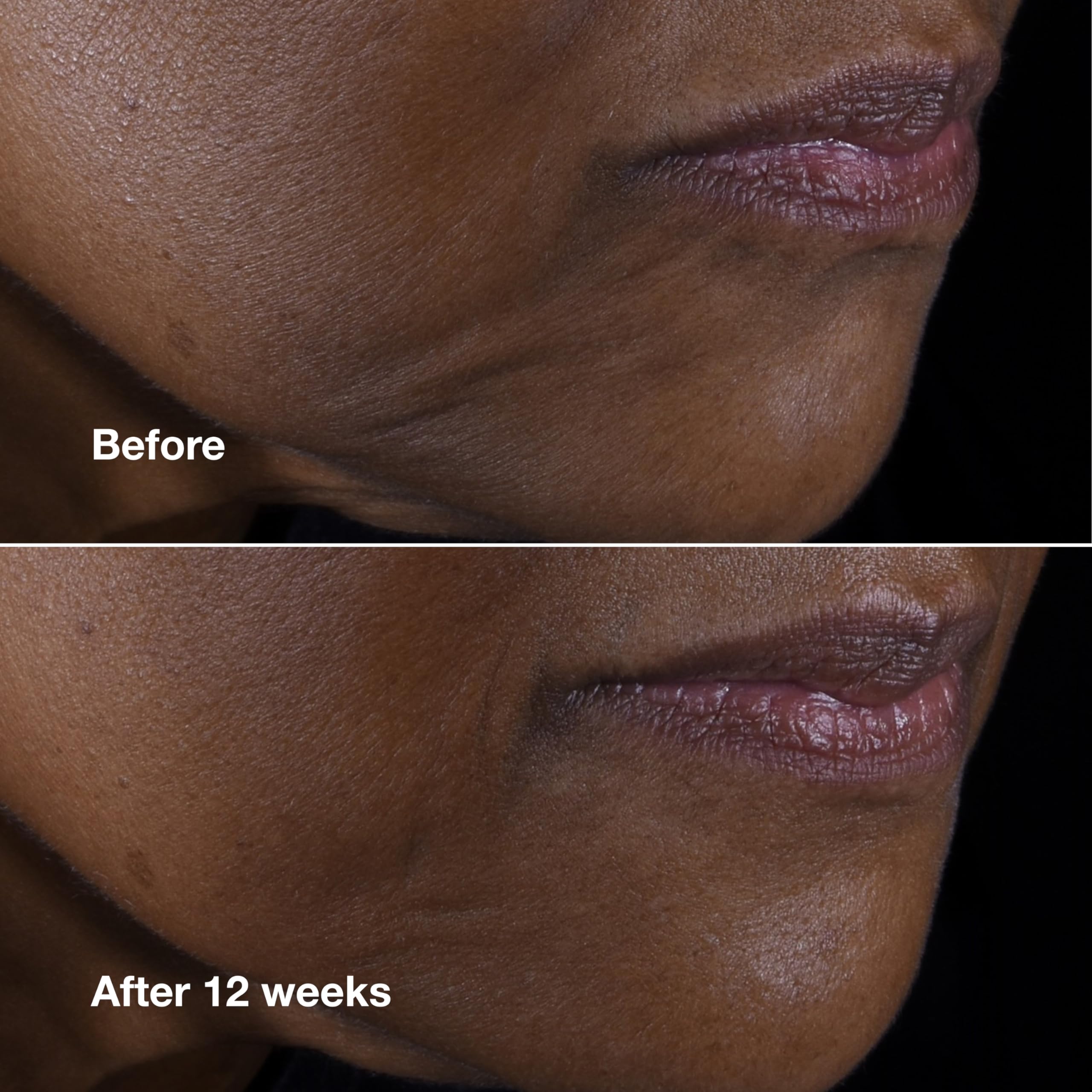 Closeup of cushiony texture on Clinique Smart Clinical Repair
