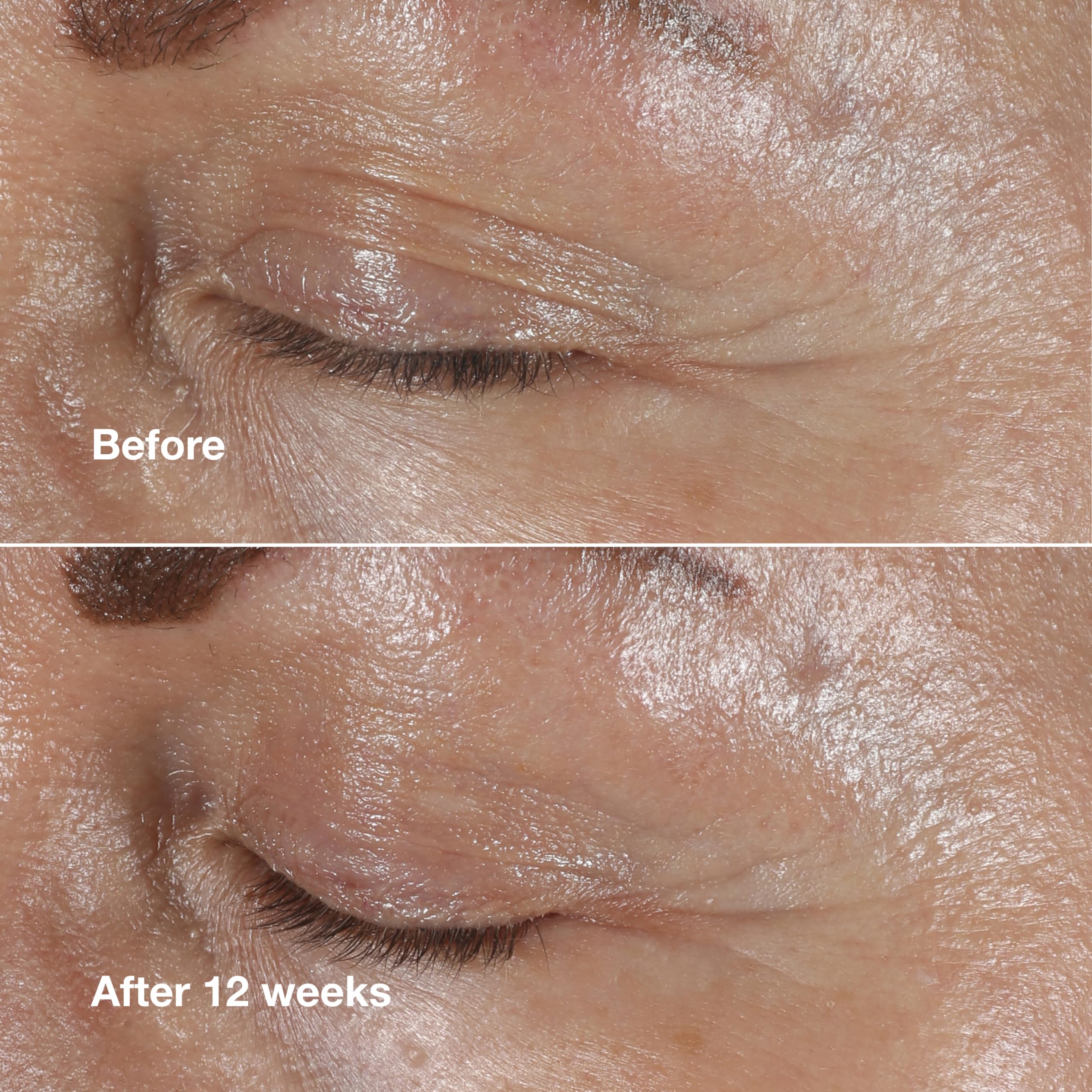 Eye cream provides brightening around the eye for a more awake appearance.