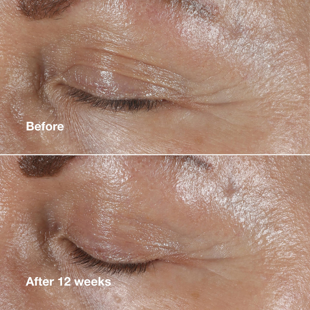 Eye cream provides brightening around the eye for a more awake appearance.