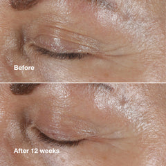 Eye cream provides brightening around the eye for a more awake appearance.