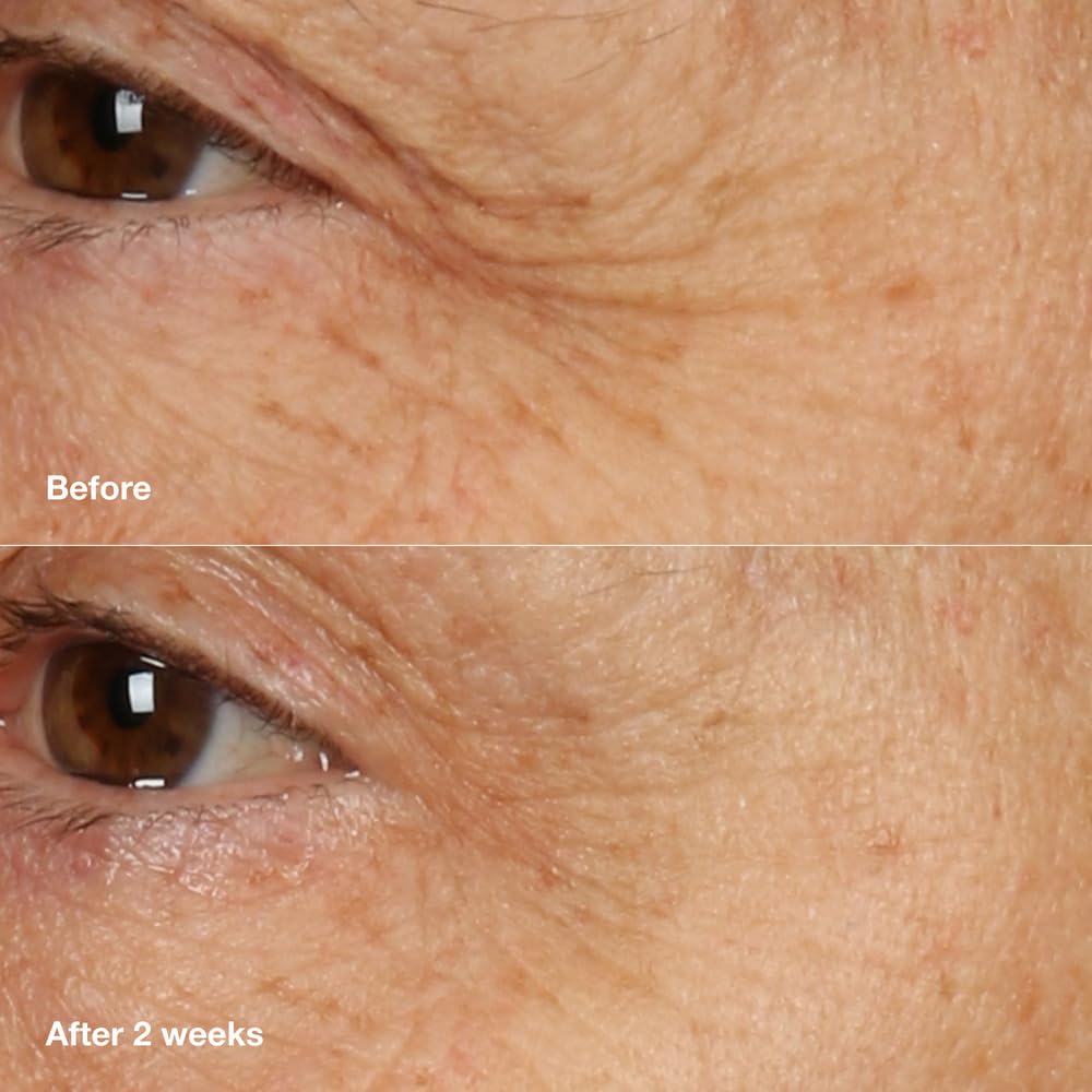 Clinique Smart Clinical Repair peptide blend supports a firmer, plump look.