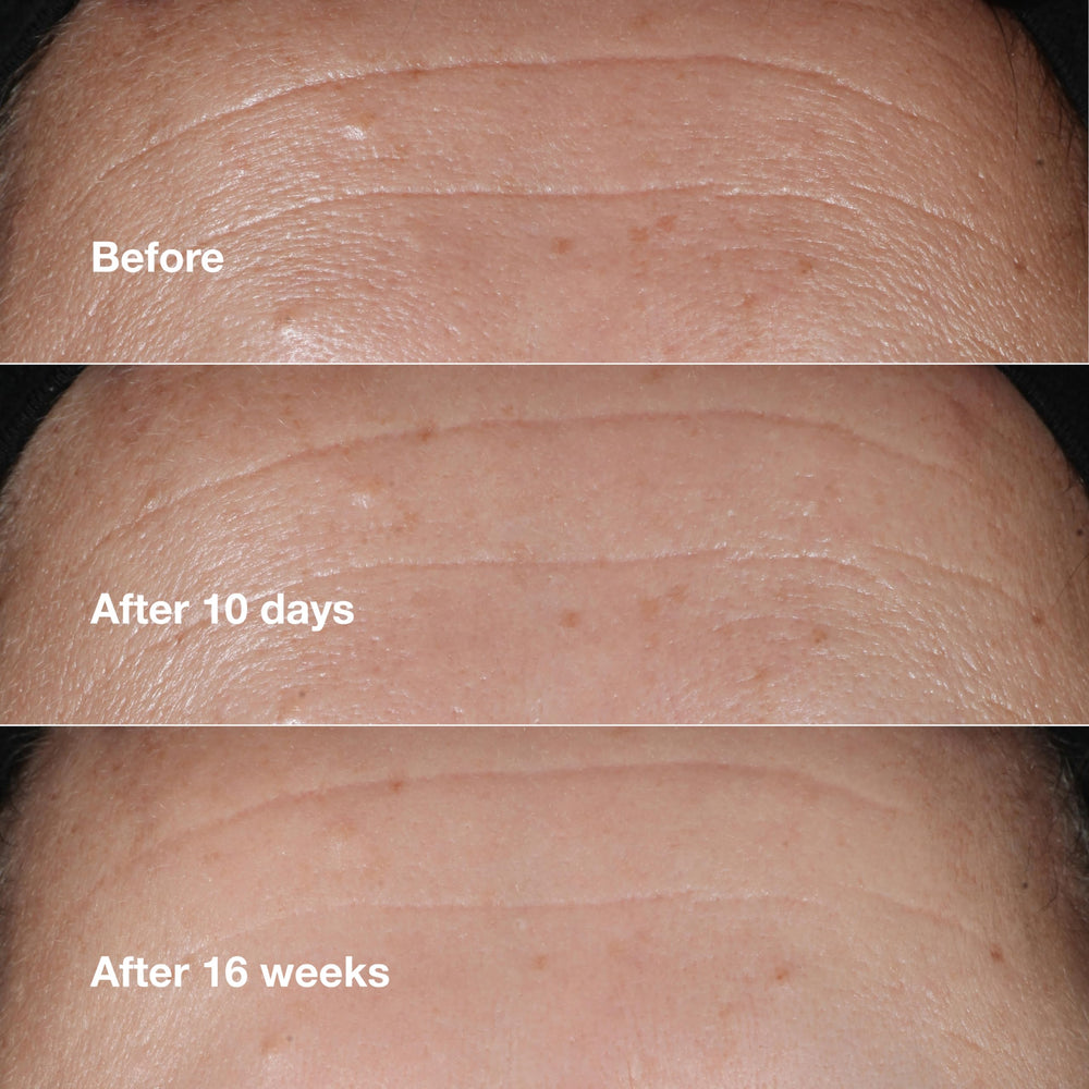 Clinique Smart Clinical Repair serum applied on skin demonstrates smooth, even coverage.