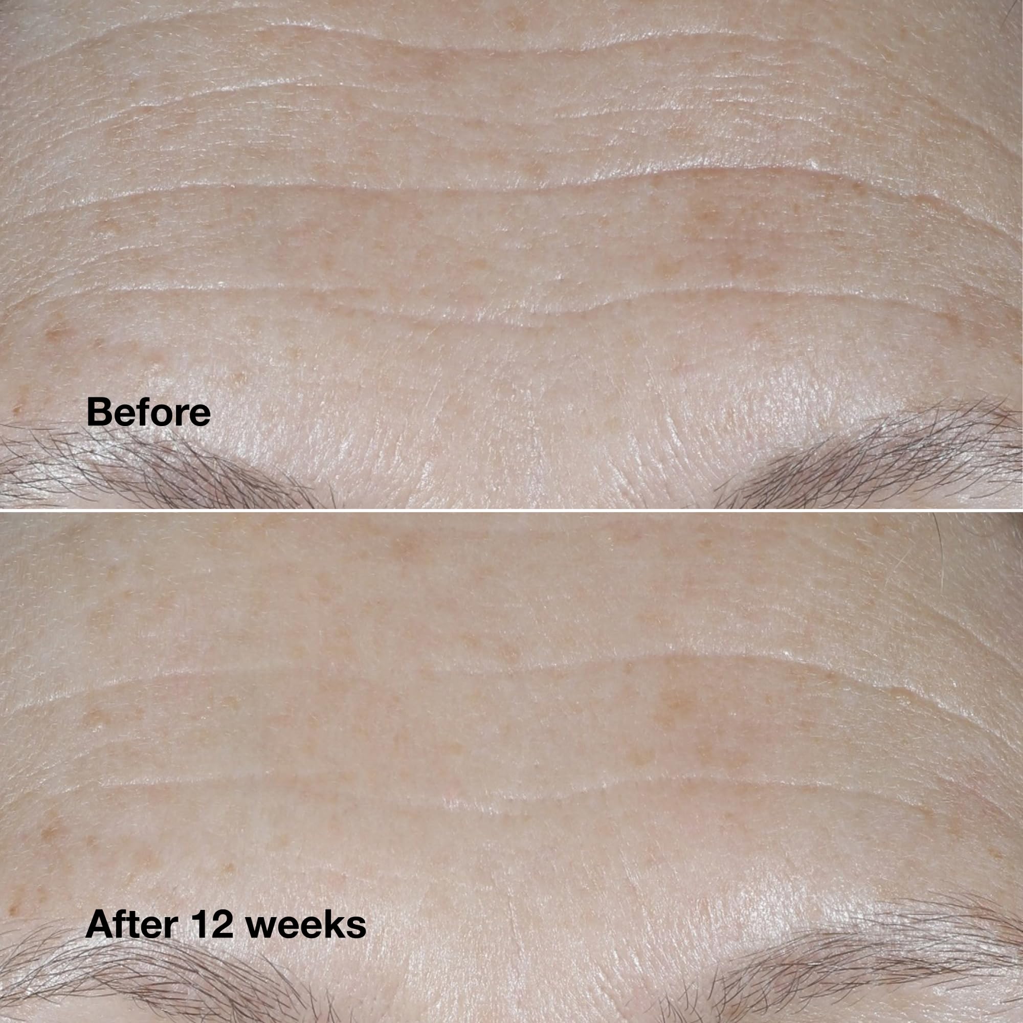 Clinique Smart Clinical Repair texture close-up illustrating quick absorption.