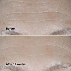 Clinique Smart Clinical Repair texture close-up illustrating quick absorption.
