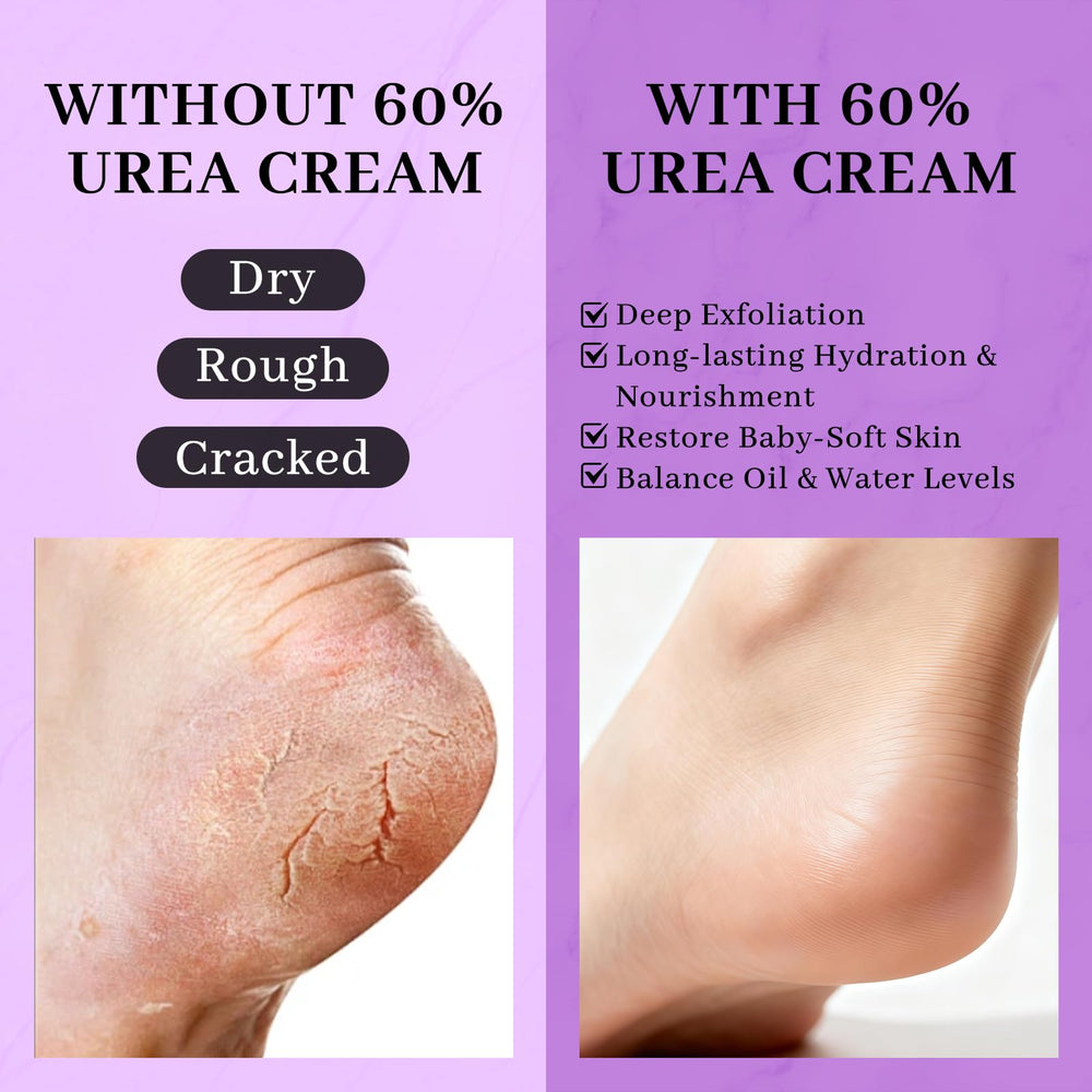 Clyecfra crema urea60 poros desobstruccion: ayuda a mantener la piel suave.
