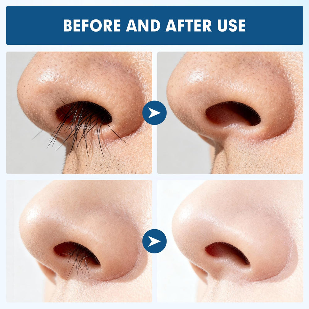 CNTVO safe-rounded edges prevent irritation during trimming sessions