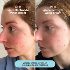 Aplicación con la mano deja el rostro suave y refrescante