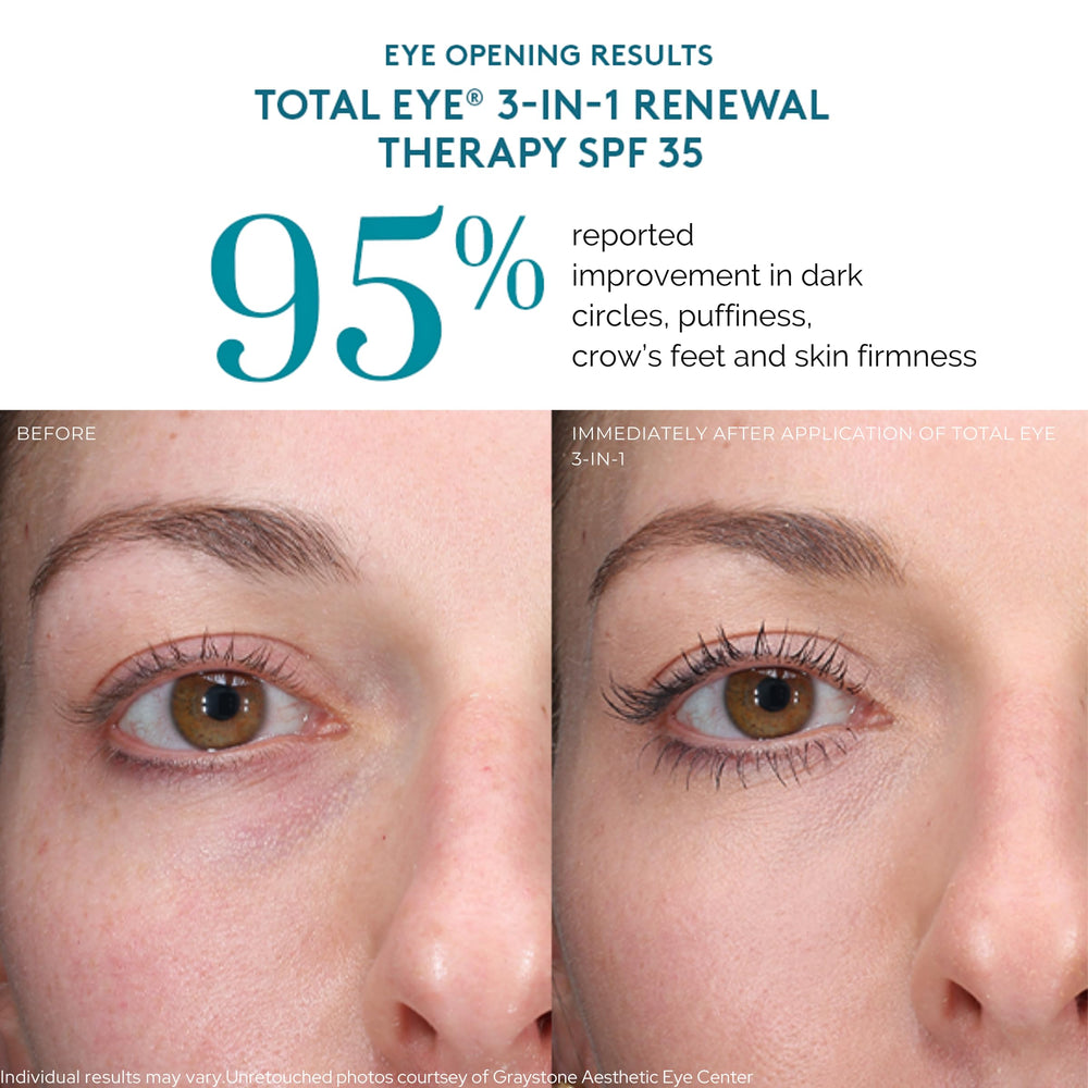 Colorescience Total Eye 3-in-1 Renewal Therapy under-eye usage demonstration