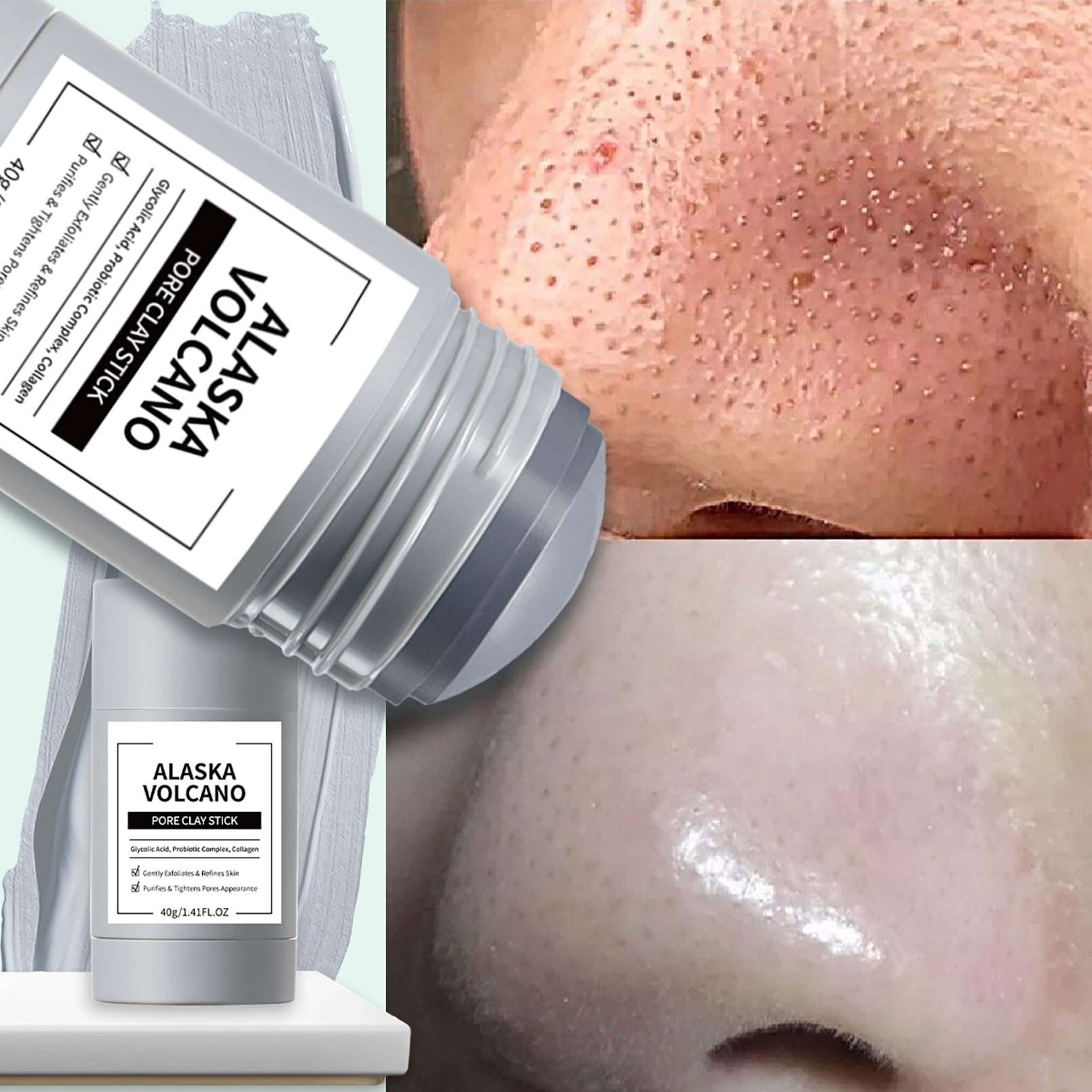 ConfidMiss mugwort acne clay stick with soothing formula for calmer-looking pores.