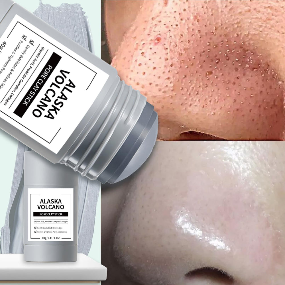 ConfidMiss mugwort acne clay stick with soothing formula for calmer-looking pores.