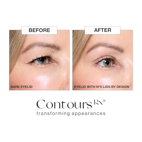 Contours Rx Lids by Design before-after look demonstrates subtle enhancement.