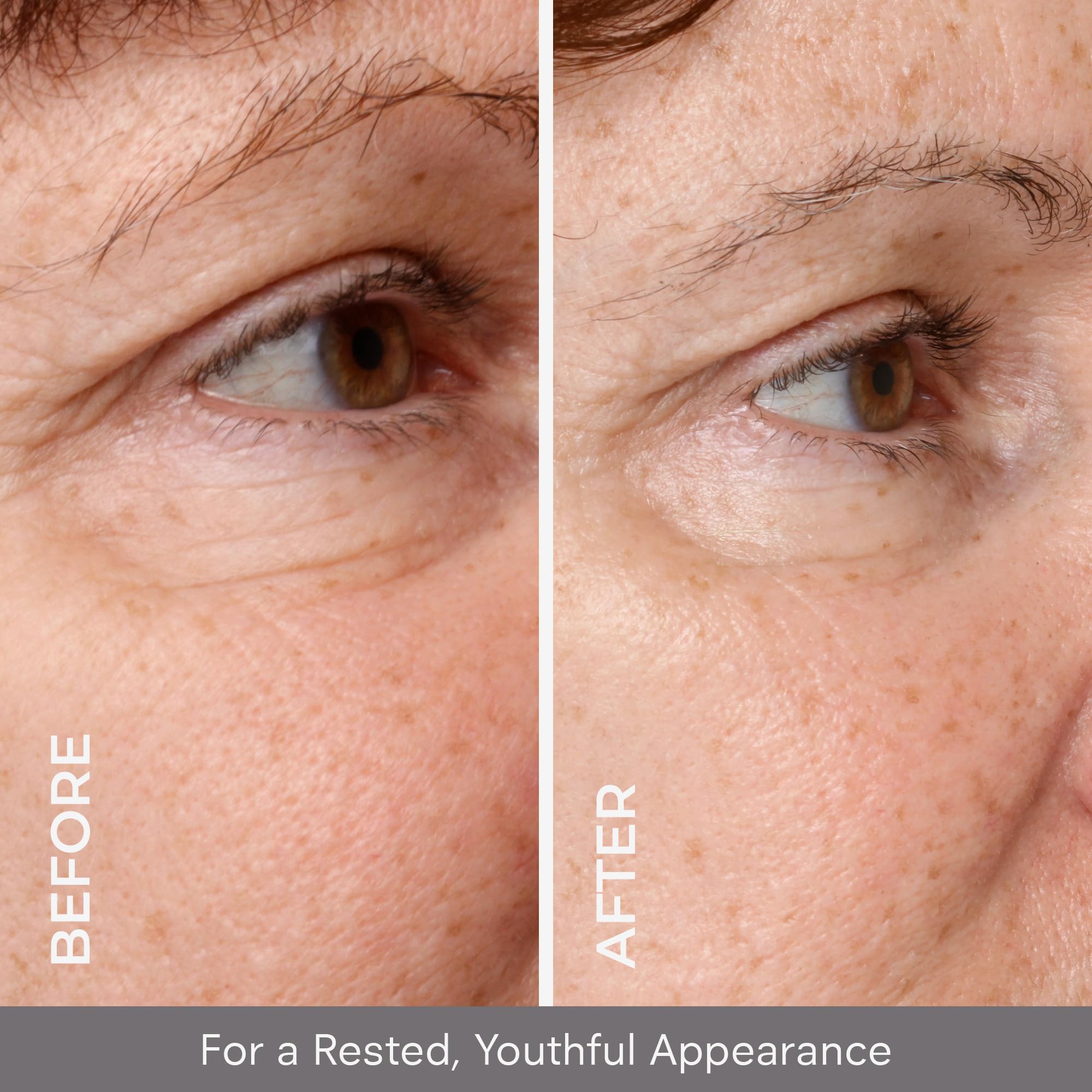 COSMEDIX Opti Crystal around-the-eye application showing soothing nourishment