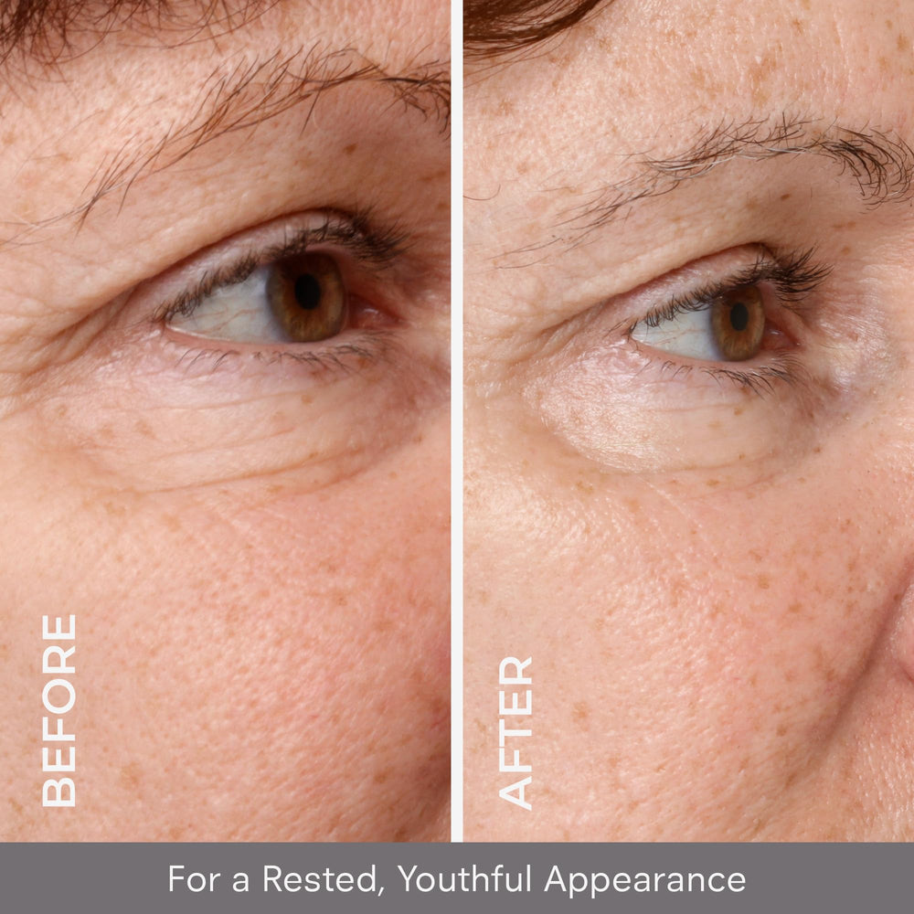 COSMEDIX Opti Crystal around-the-eye application showing soothing nourishment