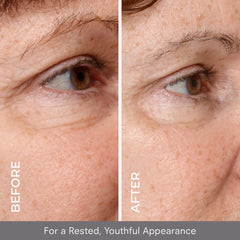 COSMEDIX Opti Crystal around-the-eye application showing soothing nourishment