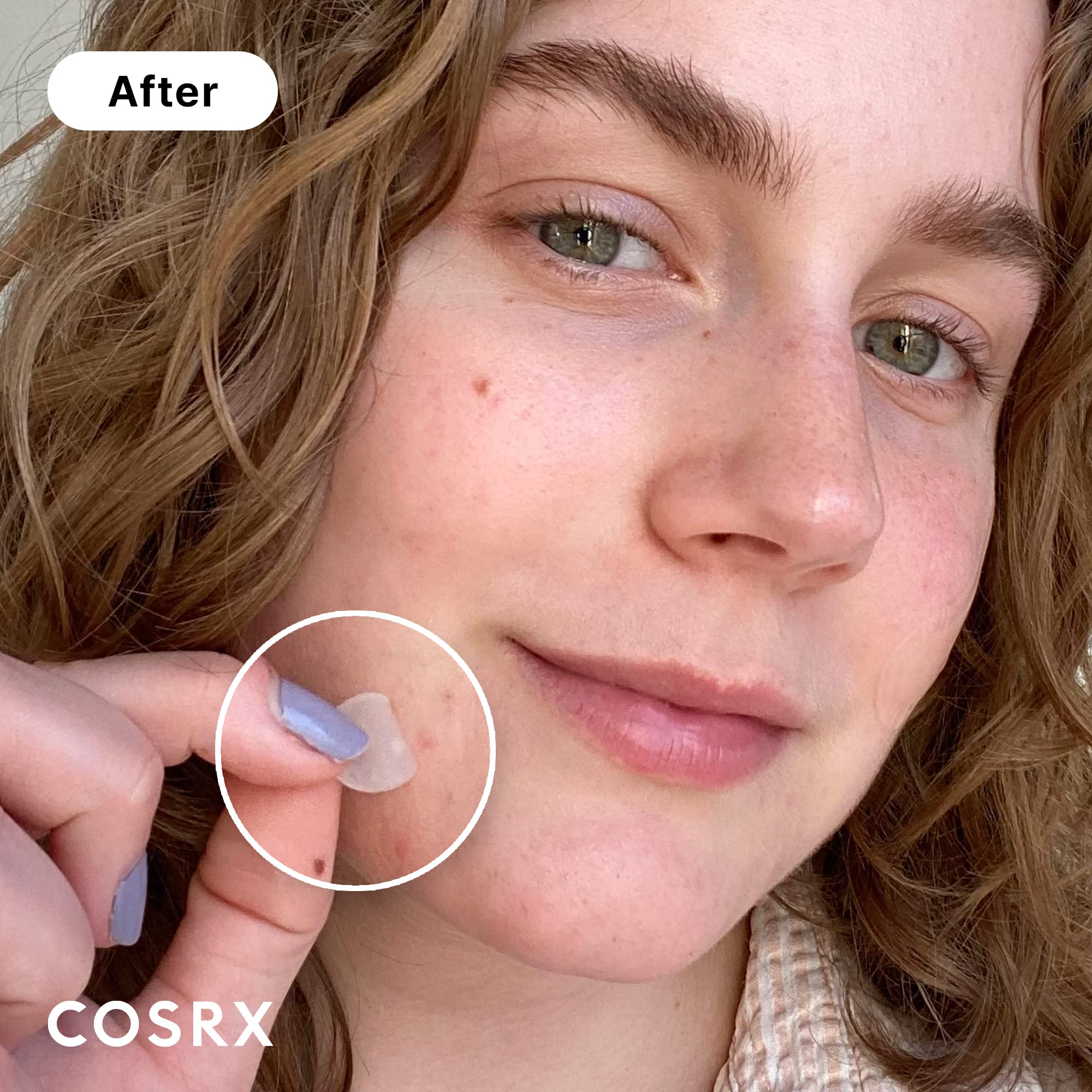 COSRX small size patch dots ideal for tiny pimples and quick coverage