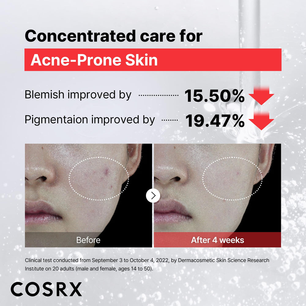 Applying COSRX reduces pore appearance with daily use