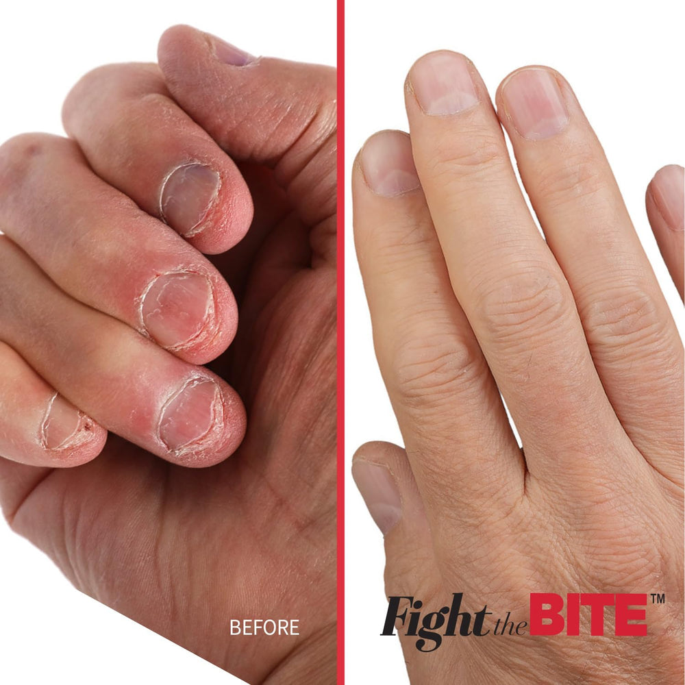 Cuccio Fight The Bite nail swatch displays invisible finish on natural nails.