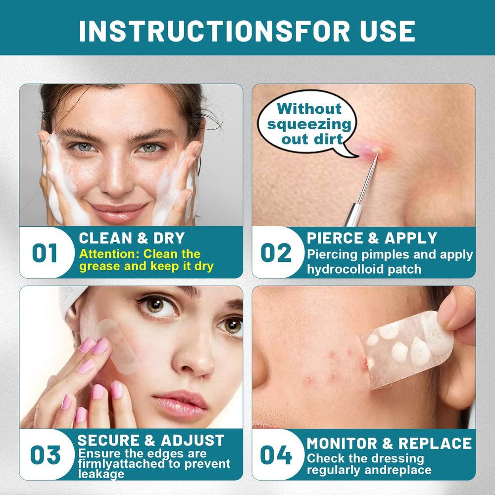 CUKWUYBY Pimple Patch Roll close-up shows transparent protection for blemishes