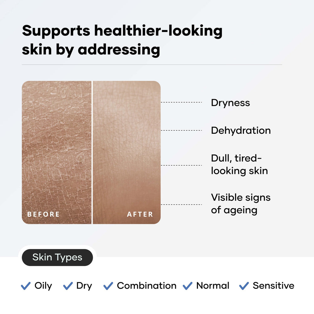 Cureskin Ceramide Moisturizer SPF40 ingredients feature ceramides and hyaluronic acid