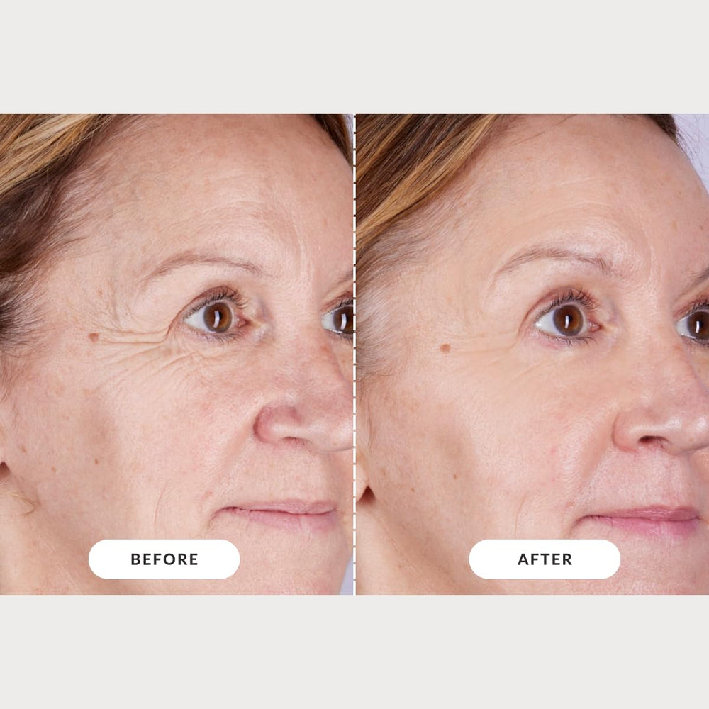 CurrentBody LED mask promotes a calm routine with hands-free use.