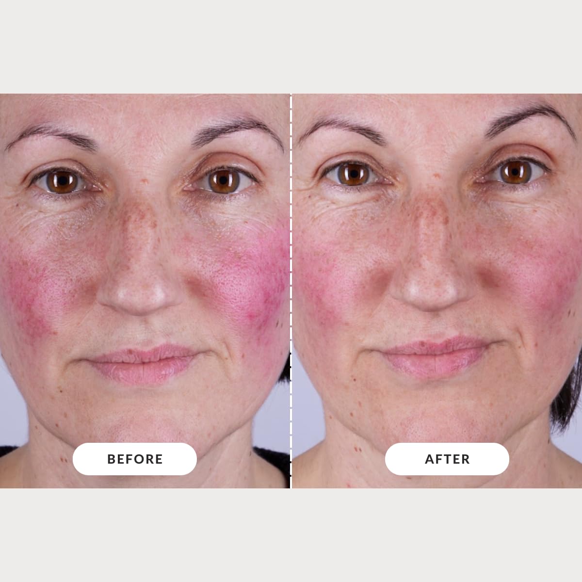 CurrentBody Skin LED mask is designed with careful safety notes for informed use.
